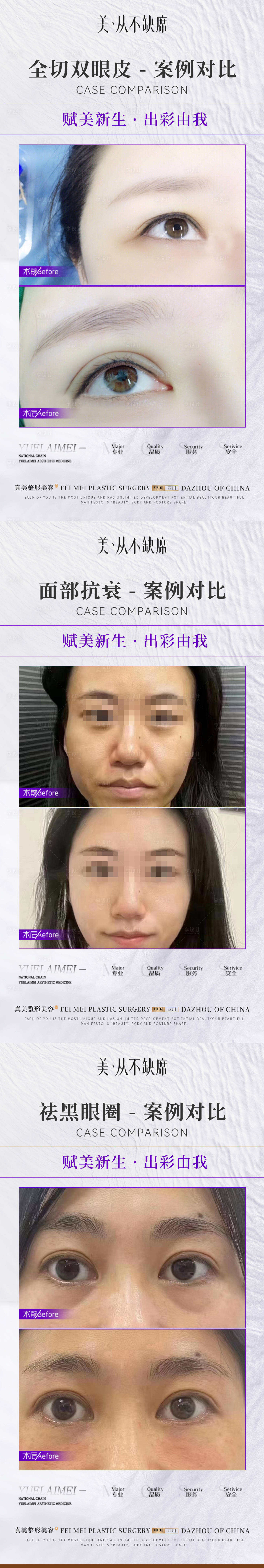 源文件下載【享設計】搜索編號：85470020027407123【醫美整形簡約案例對比系列海報】