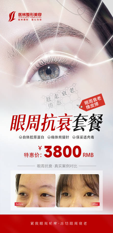 源文件下载【享设计】搜索编号：35250020082221620【眼周抗衰活动海报】