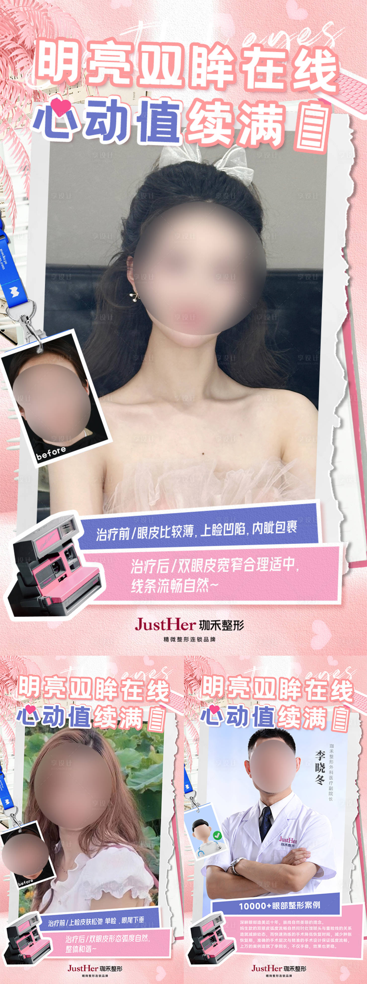 源文件下载【享设计】搜索编号：32980019621497995【双眼皮案例对比海报】