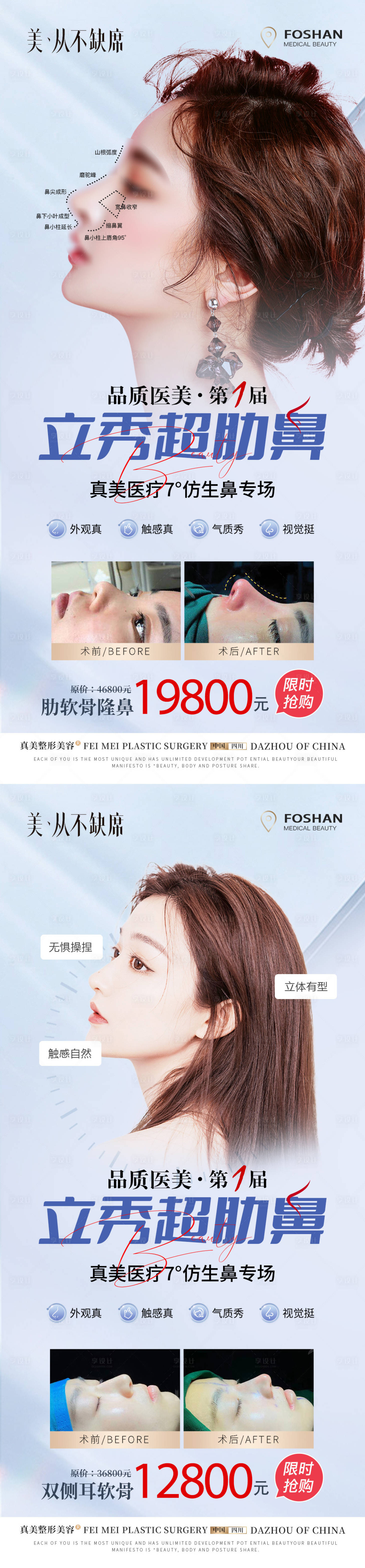 源文件下載【醫美鼻綜合隆鼻案例活動】編號：77980019894396714