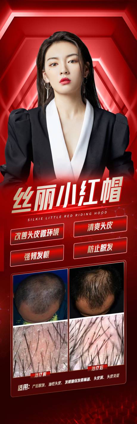 源文件下载【植发长图】编号：78320019669697663