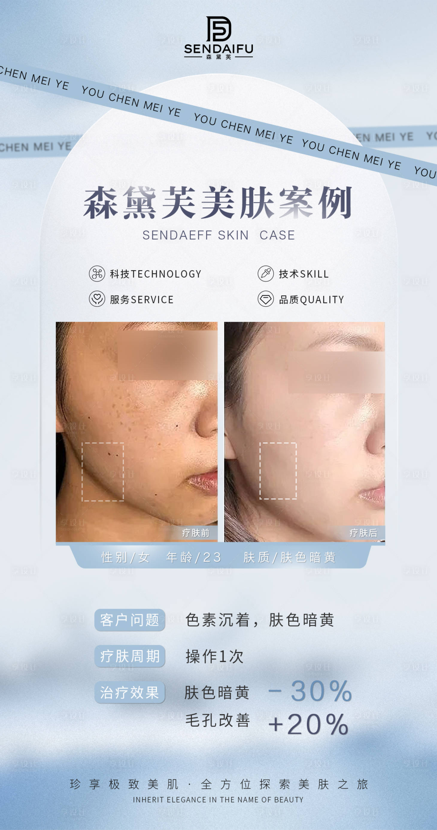 源文件下载【享设计】搜索编号：70630019898933918【皮肤案列宣传海报】