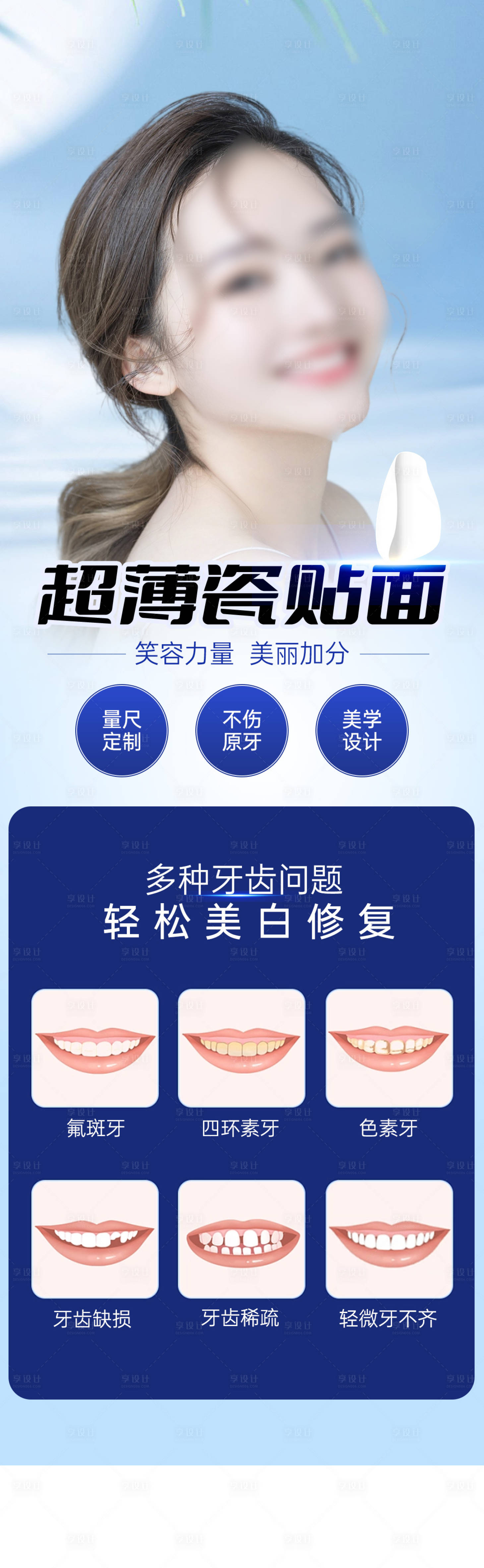源文件下载【享设计】搜索编号：94890020035384855【口腔瓷贴面科普海报】