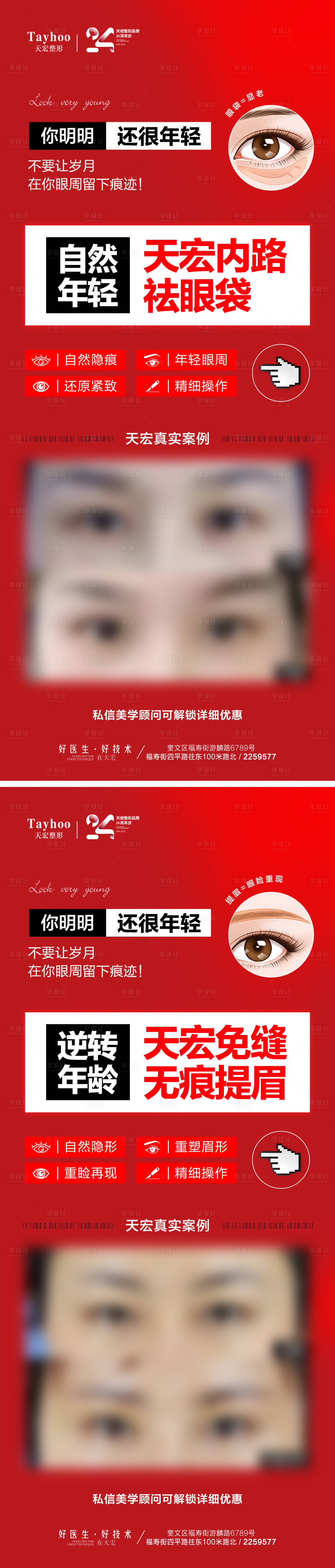 源文件下载【医美整形案例海报】编号：54640020072802098