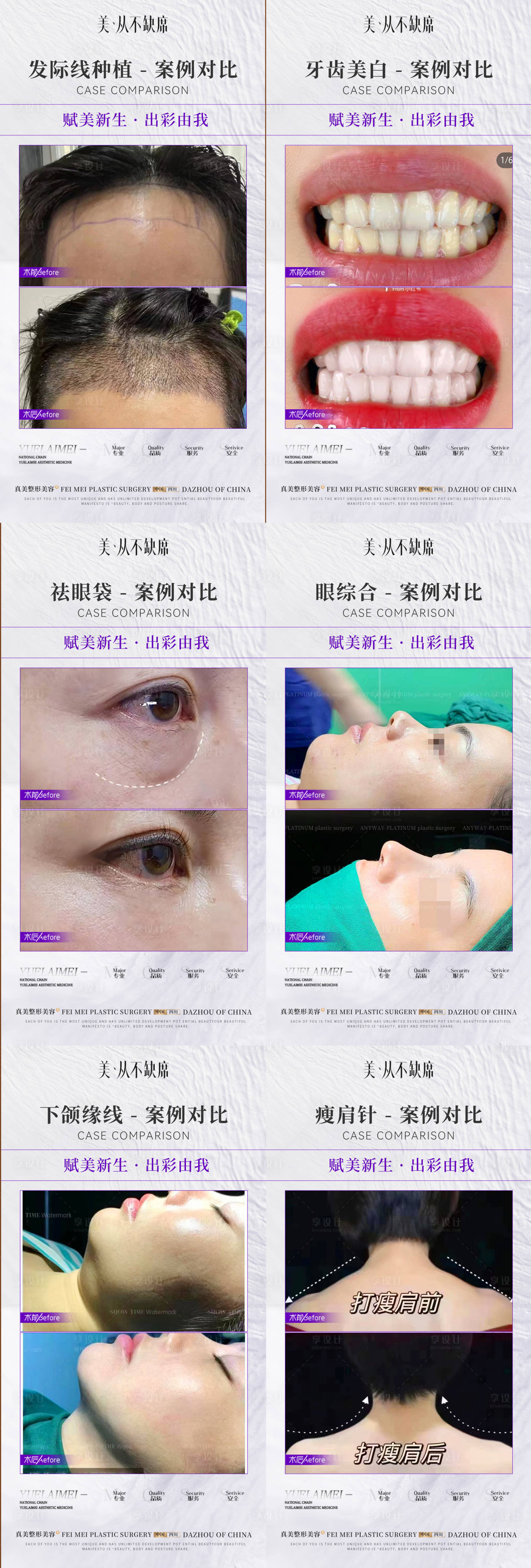 源文件下载【享设计】搜索编号：72120019806389214【医美整形简约案例对比】