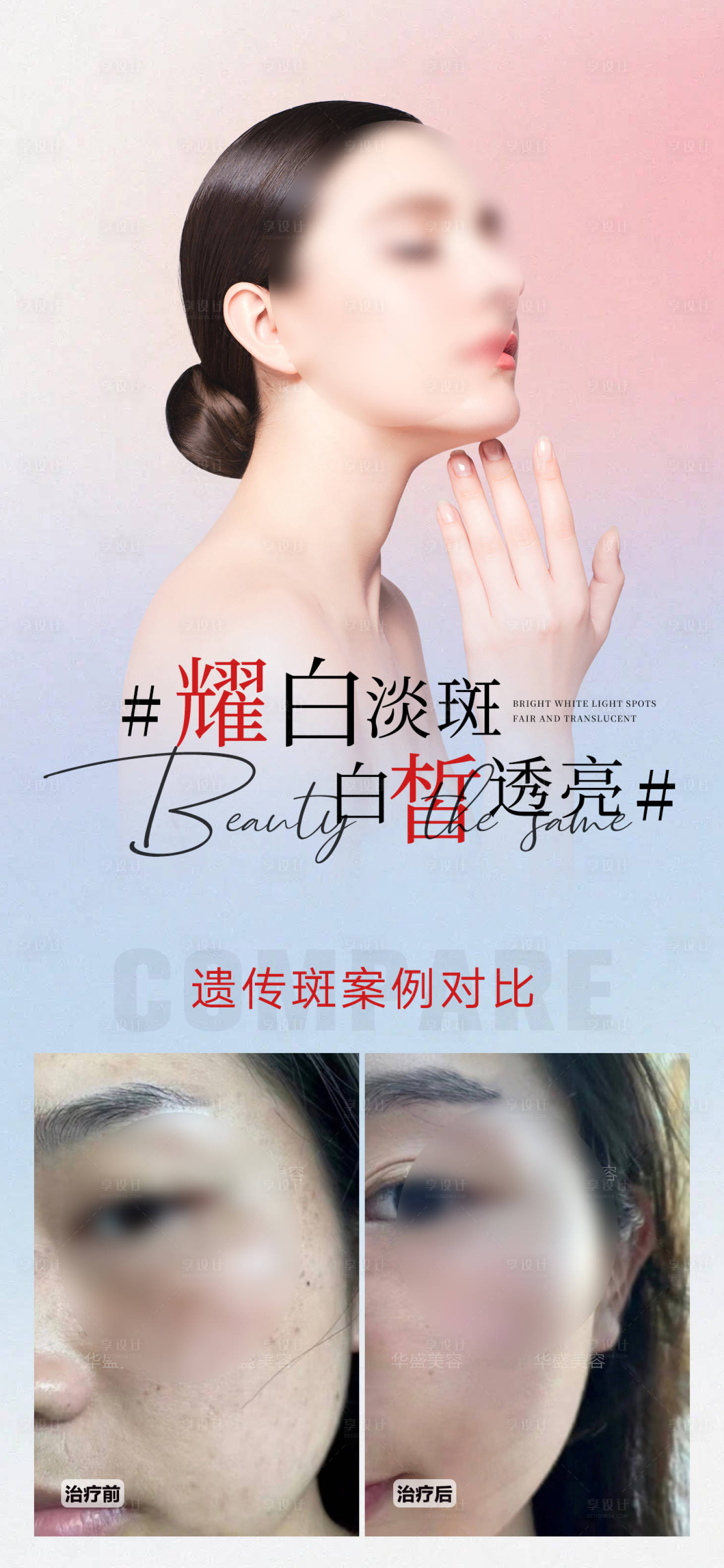源文件下載【祛斑海報(bào)】編號(hào)：76160020036096624