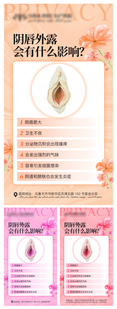 源文件下载【阴唇外露会有什么影响】编号：69560020091635989
