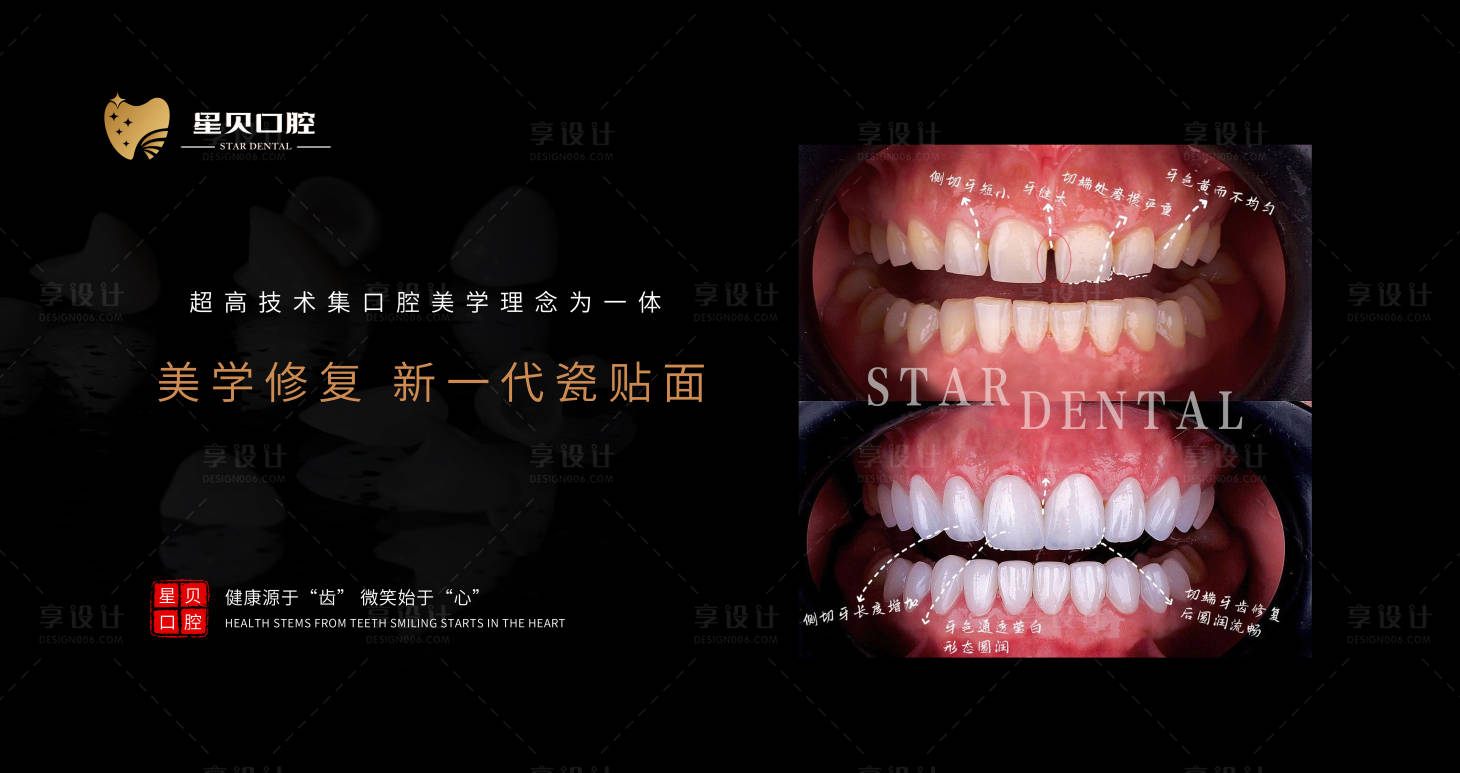 源文件下載【享設計】搜索編號：80030019837135361【口腔宣傳海報】