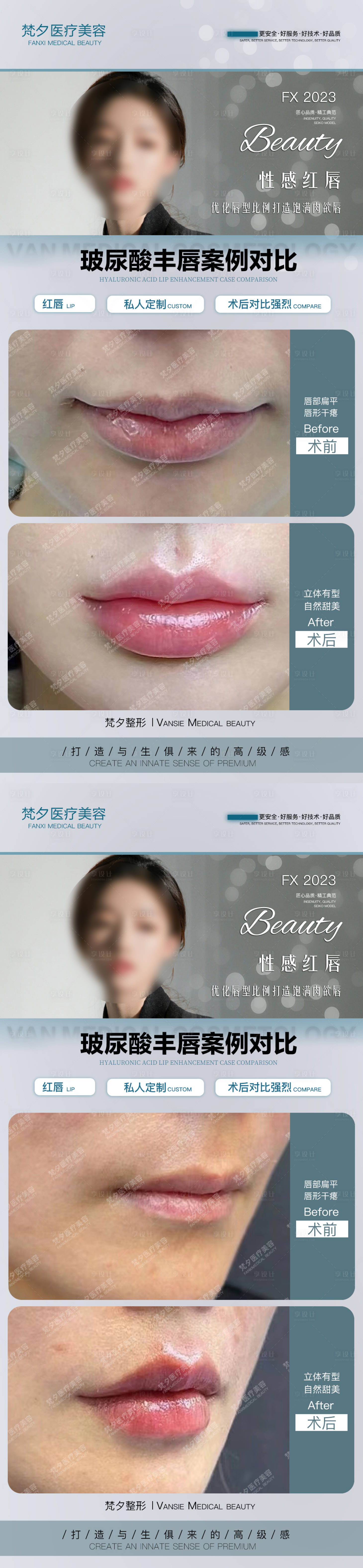 源文件下载【玻尿酸丰唇海报】编号：11360019913929731