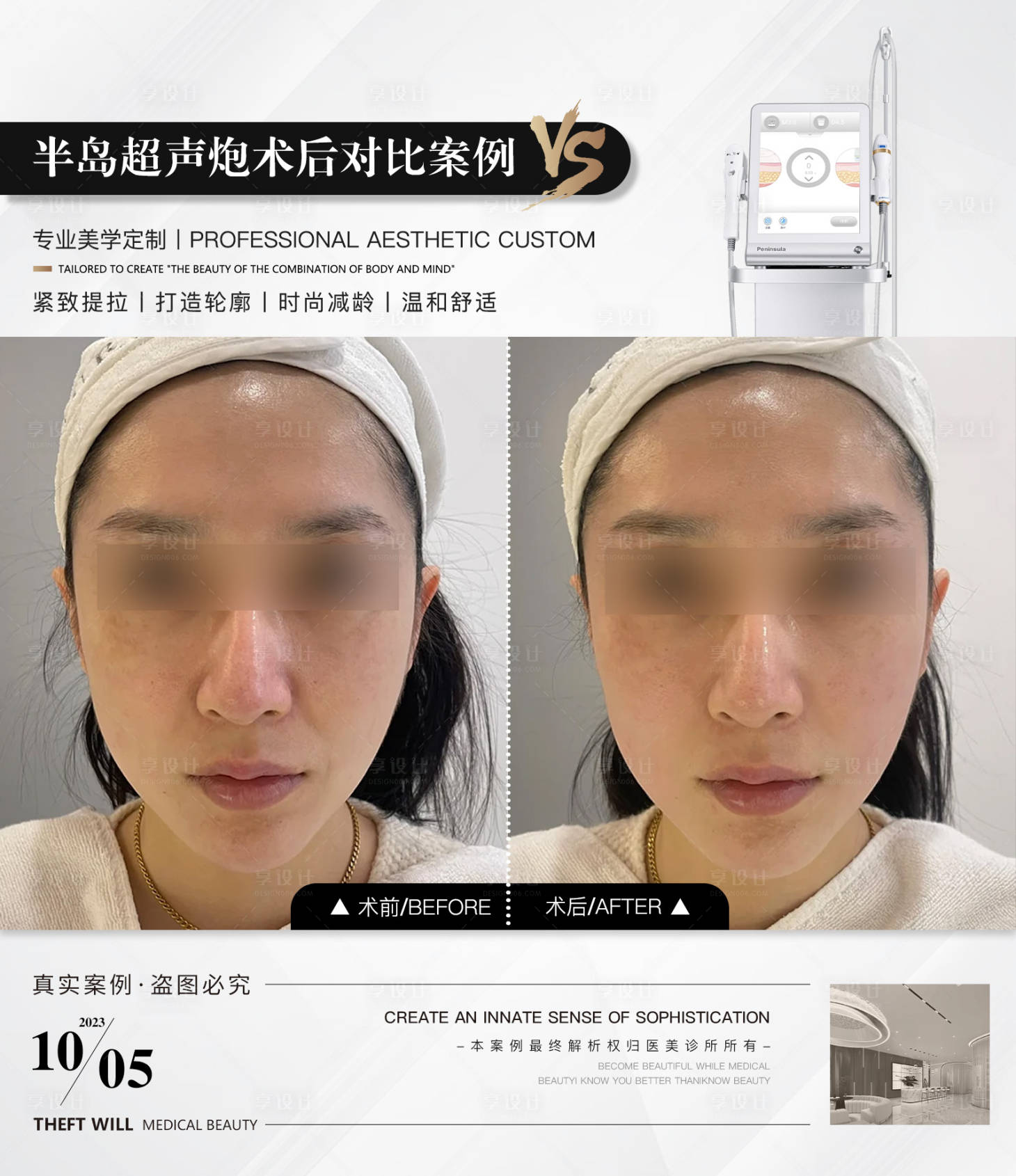 源文件下载【享设计】搜索编号：60740019810265976【案例对比】