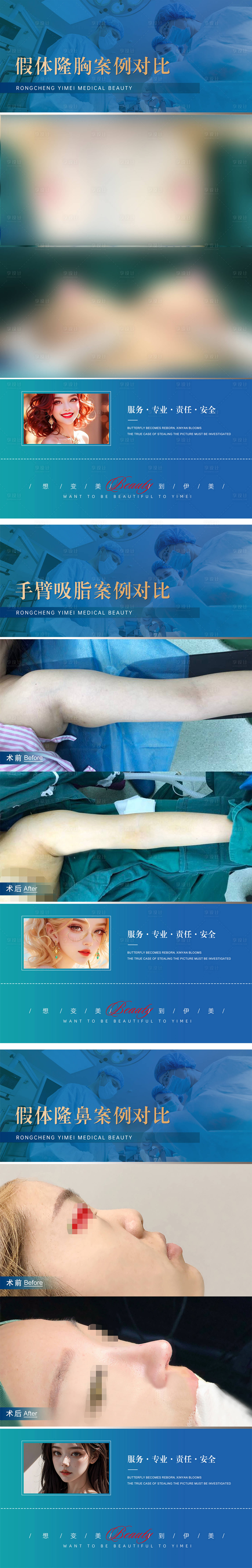 源文件下载【医美整形案例海报】编号：35960019648777702