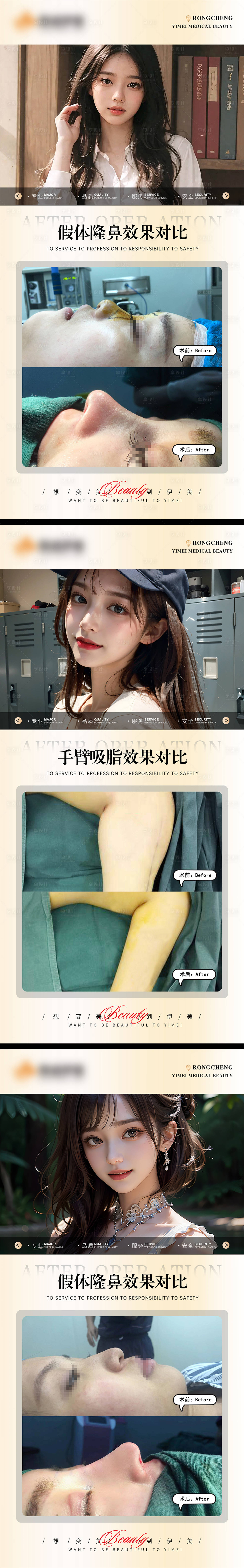 源文件下載【享設(shè)計】搜索編號：36100019983239467【醫(yī)美案例模板對比系列海報】