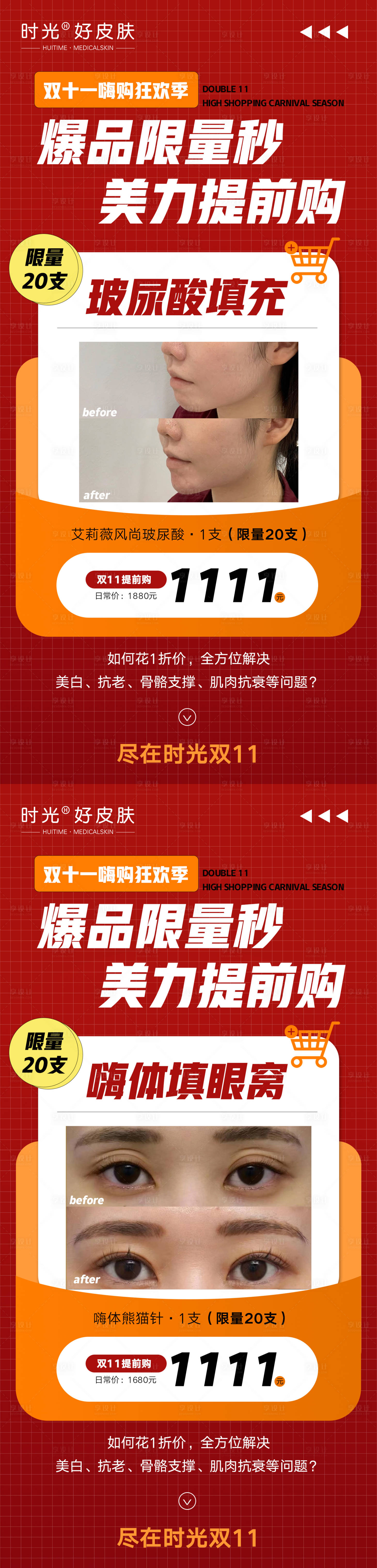 源文件下載【享設(shè)計(jì)】搜索編號(hào)：87920020118928508【醫(yī)美項(xiàng)目秒殺海報(bào)】