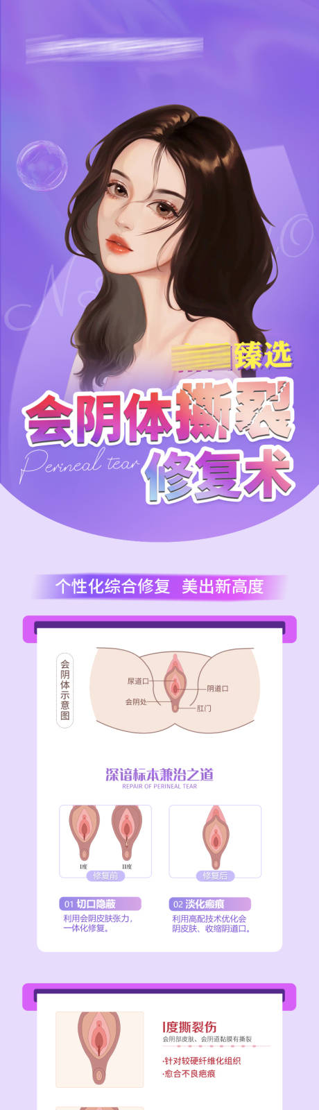 源文件下载【医美会阴体撕裂修复术】编号：93060019728724308