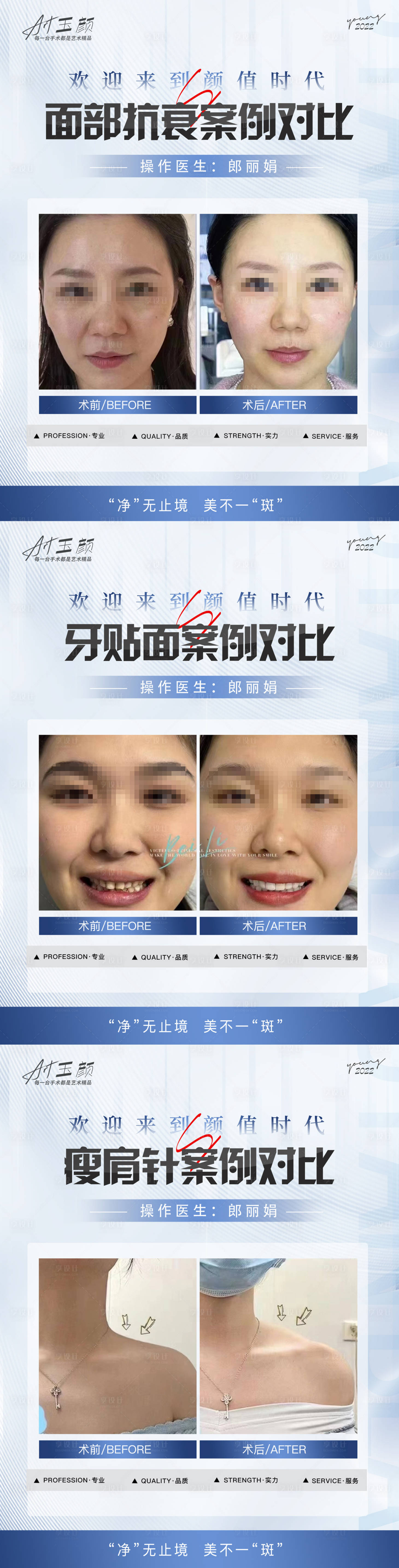 源文件下載【享設計】搜索編號：79870019849171071【整形口腔案例對比海報】