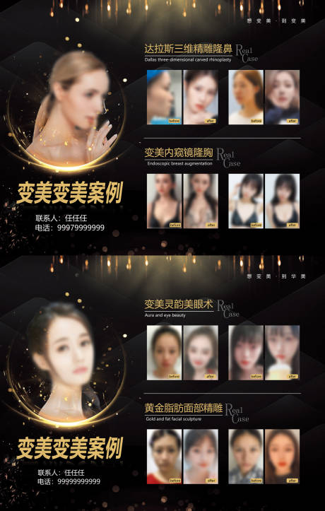 源文件下载【医美暗金变美案例对比展示】编号：95120019727895639