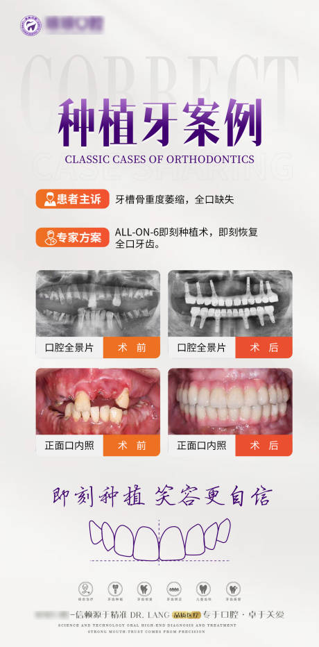 编号：20231013211436895【享设计】源文件下载-口腔种植牙案例对比海报