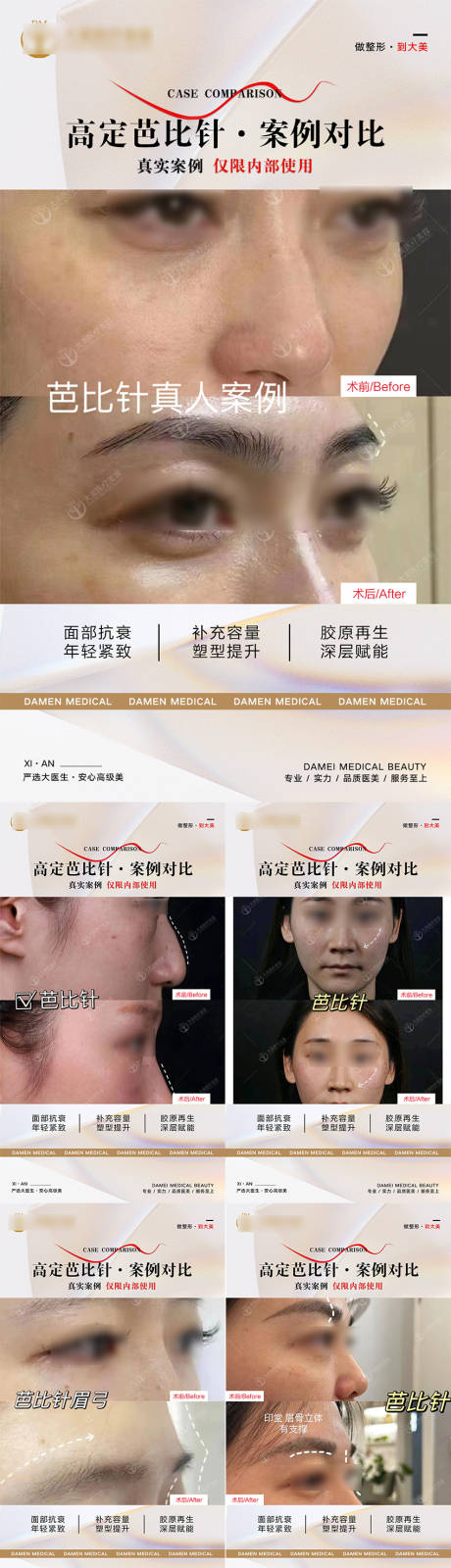 源文件下载【医美整形 】编号：49000019812292934