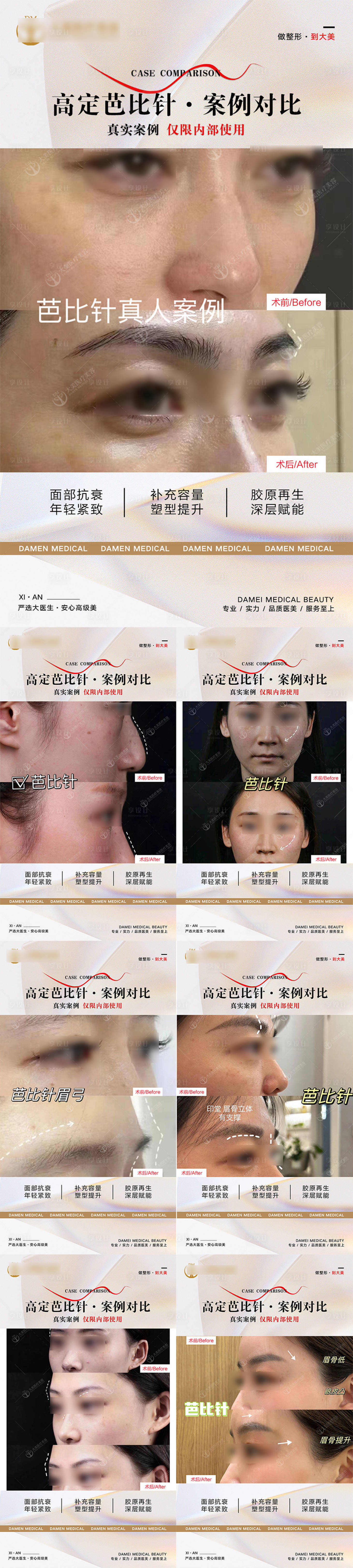 源文件下载【享设计】搜索编号：49000019812292934【医美整形 】
