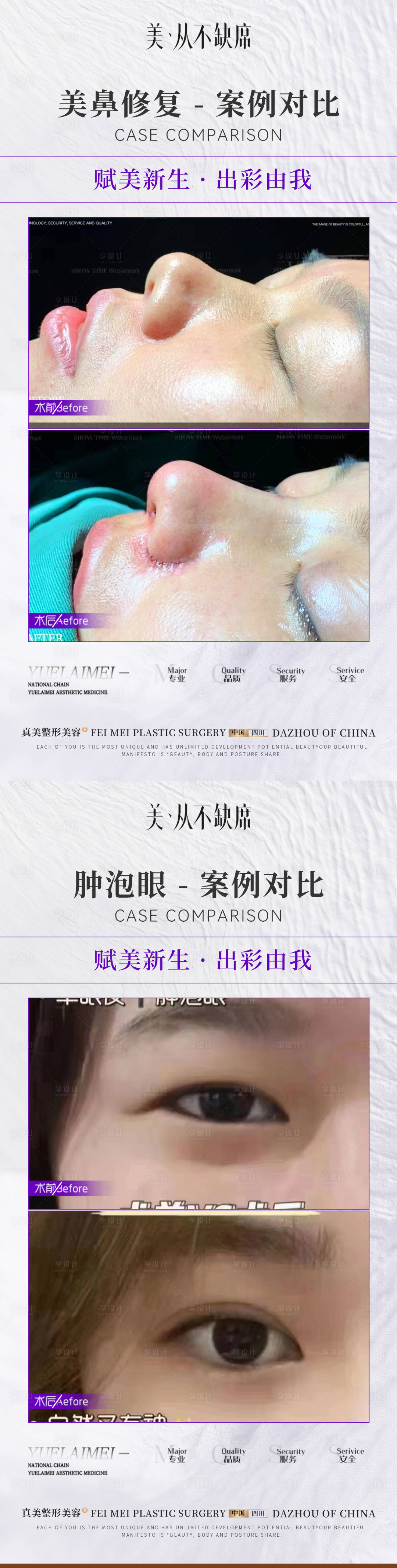 源文件下载【医美整形简约案例对比】编号：92390019894077382