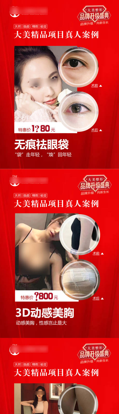源文件下載【享設計】搜索編號：41760019715464687【醫美整形案例對比系列海報】