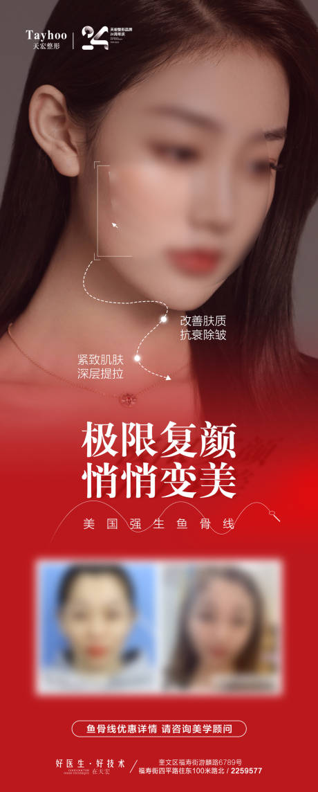 源文件下载【鱼骨线案例海报】编号：36930020049459265
