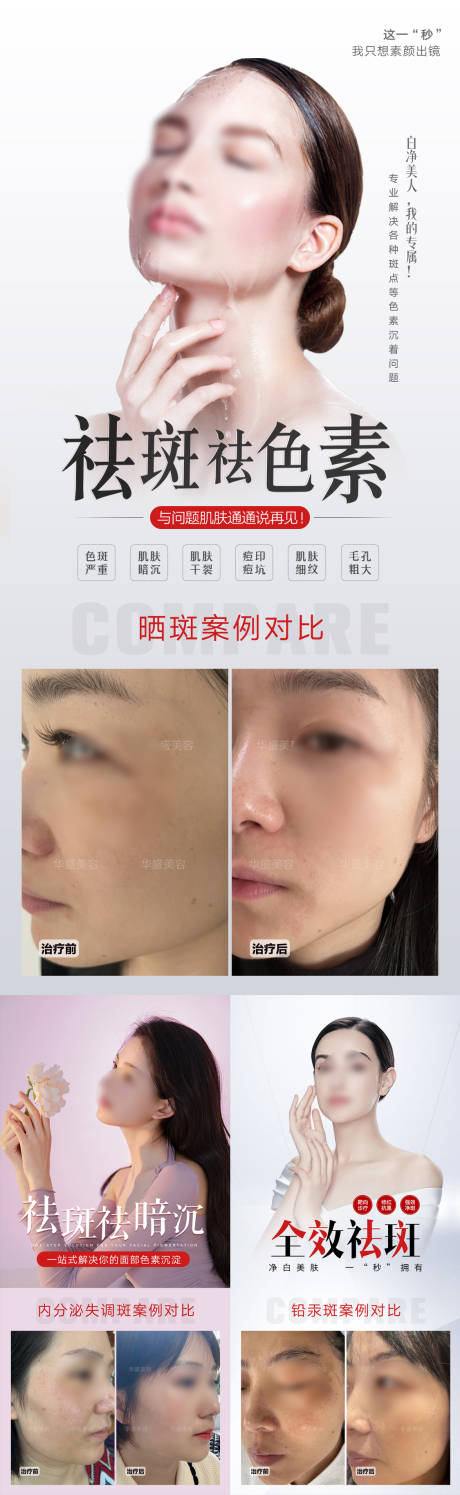 源文件下载【美业祛斑祛痣案例海报】编号：41470019748406092
