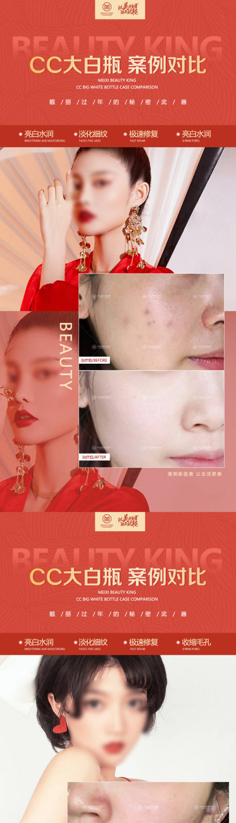 源文件下载【医美案例合集对比系列海报】编号：68670020023158020