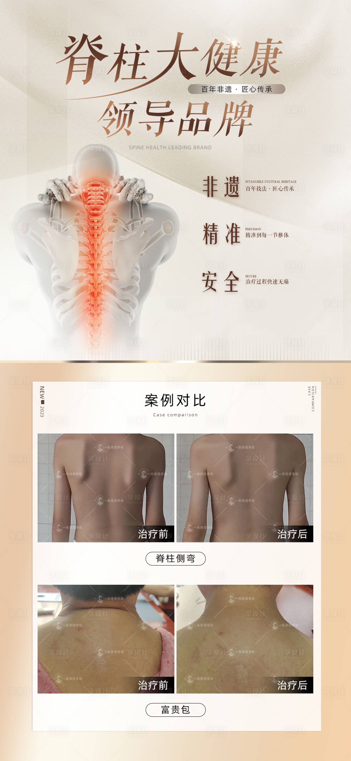 源文件下载【享设计】搜索编号：98070019967284880【脊柱案例对比海报】
