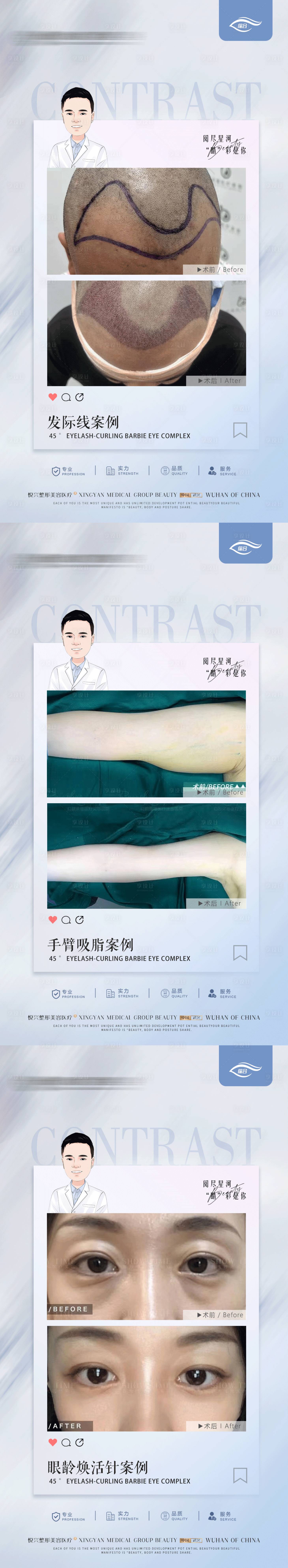 源文件下载【医美整形案例海报】编号：15780019849189571