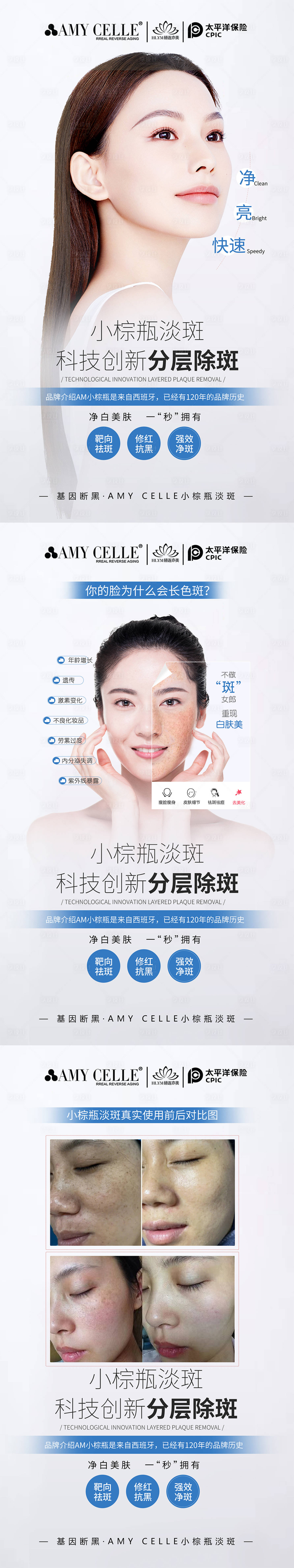 源文件下載【享設(shè)計(jì)】搜索編號：23740019944662584【醫(yī)美祛斑海報(bào)】