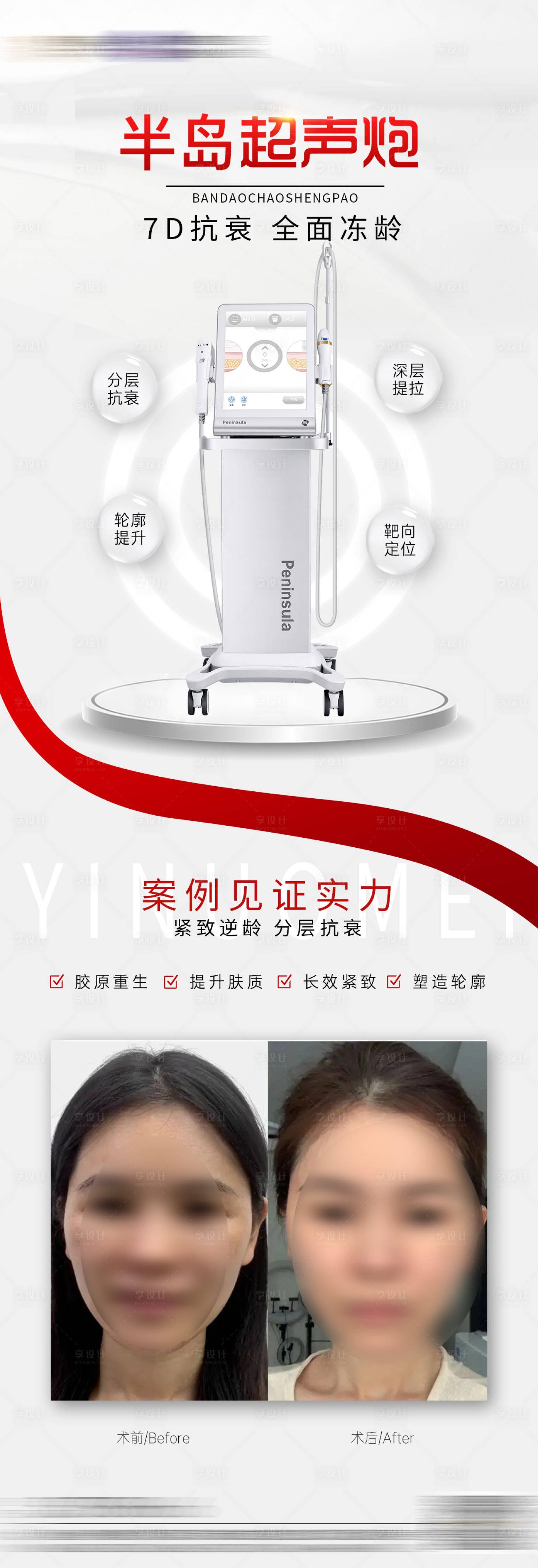 源文件下载【享设计】搜索编号：95300019687981114【医美半岛超声炮案例海报】