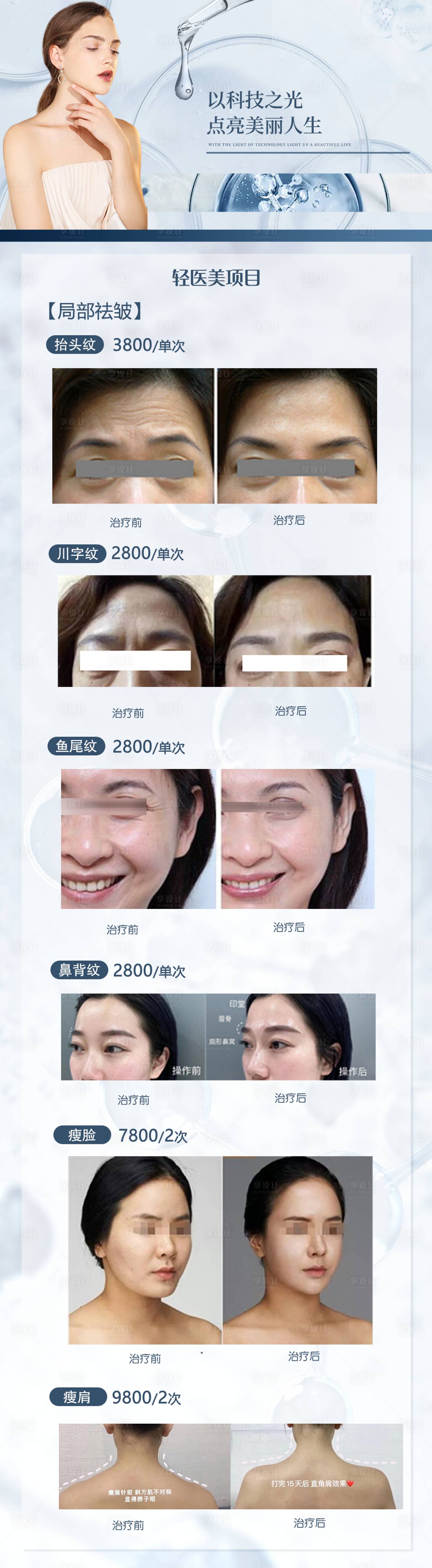 源文件下载【轻医美局部祛皱海报】编号：83950019622066364