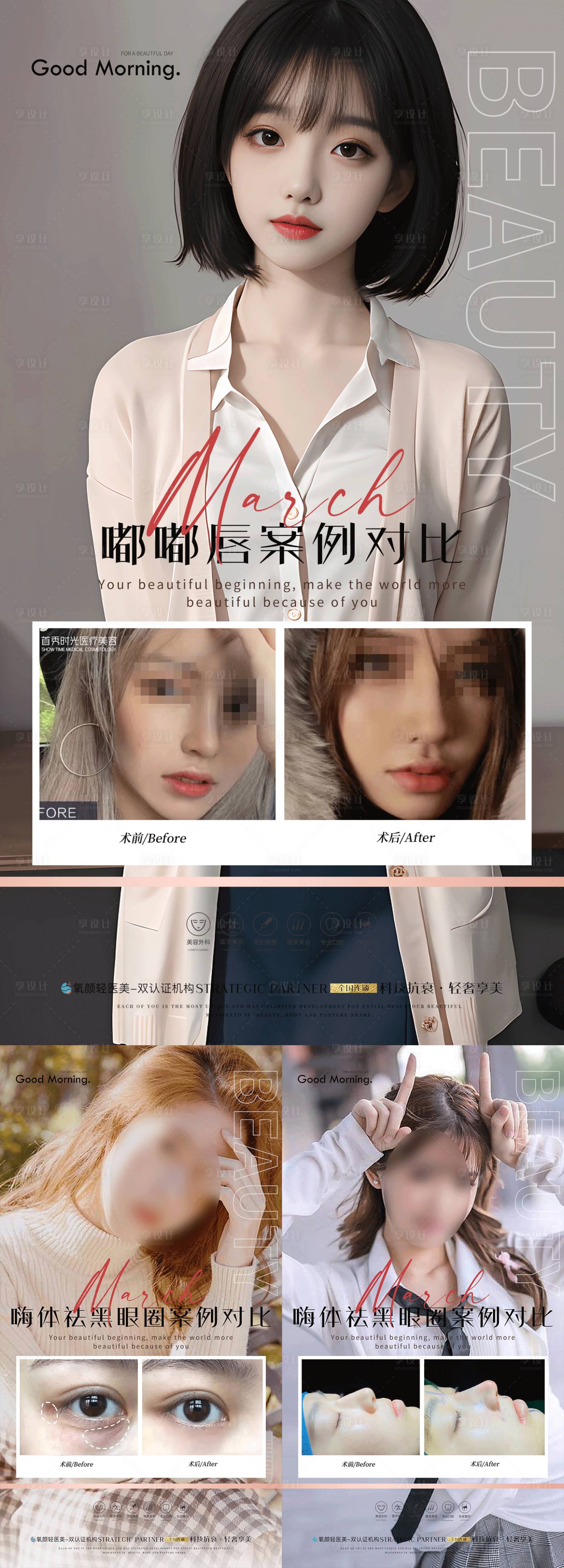 源文件下载【享设计】搜索编号：35870020077062515【医美整形案例对比海报】