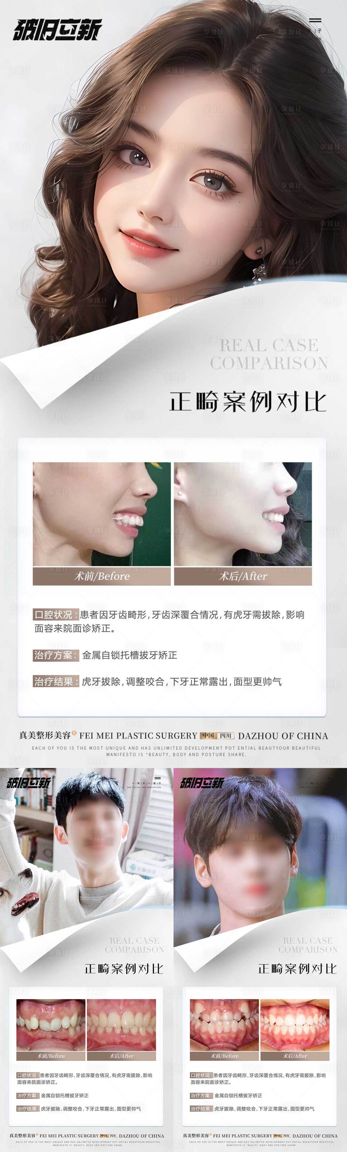 源文件下載【享設計】搜索編號：60980020027616423【矯正正畸案例對比】