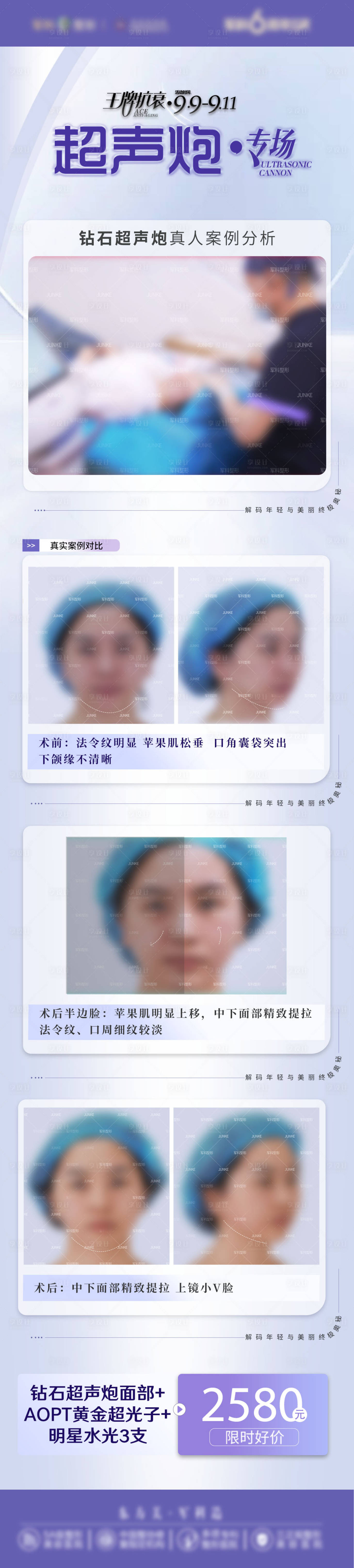 源文件下载【享设计】搜索编号：38150020036637884【超声炮专场医美长图海报】