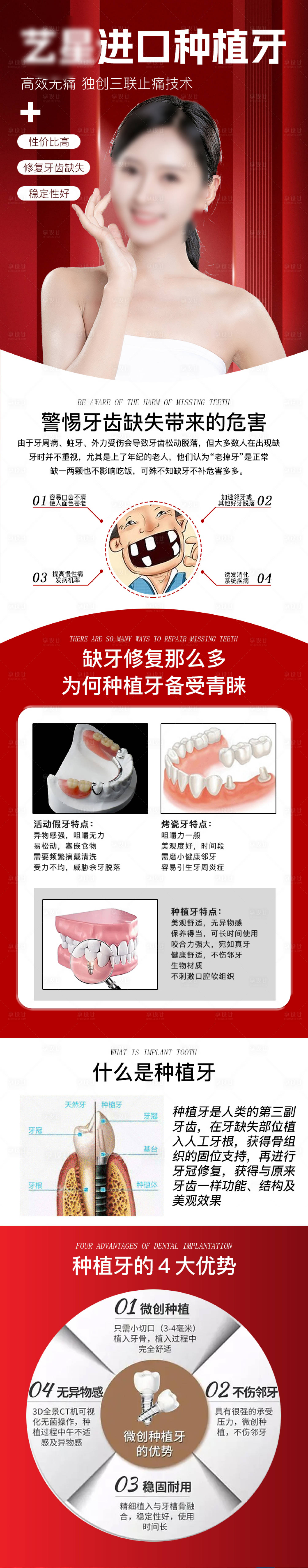 源文件下载【享设计】搜索编号：49760019865284539【进口种植牙详情页】
