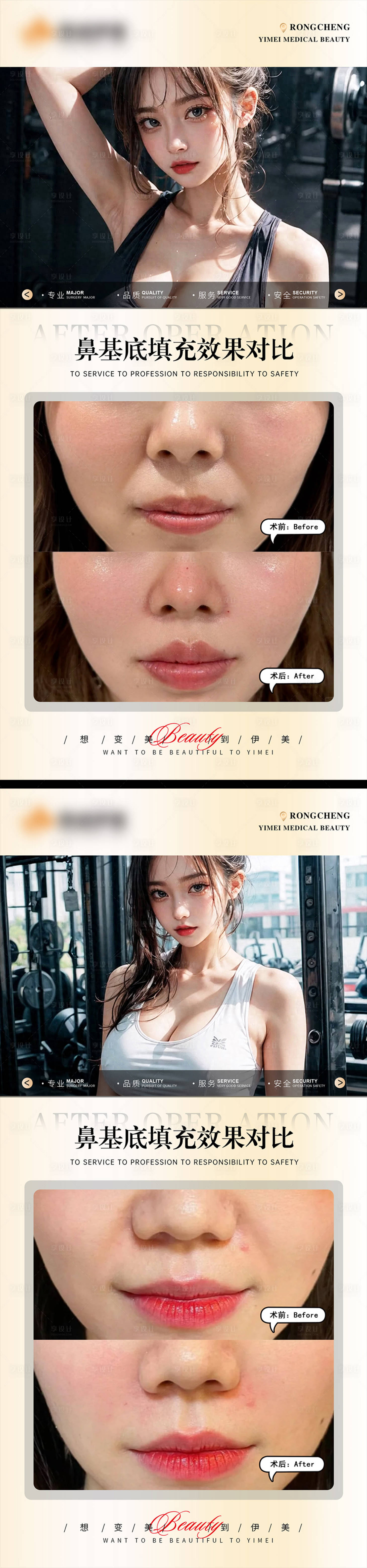 源文件下载【医美案例对比模板】编号：17000019946701365