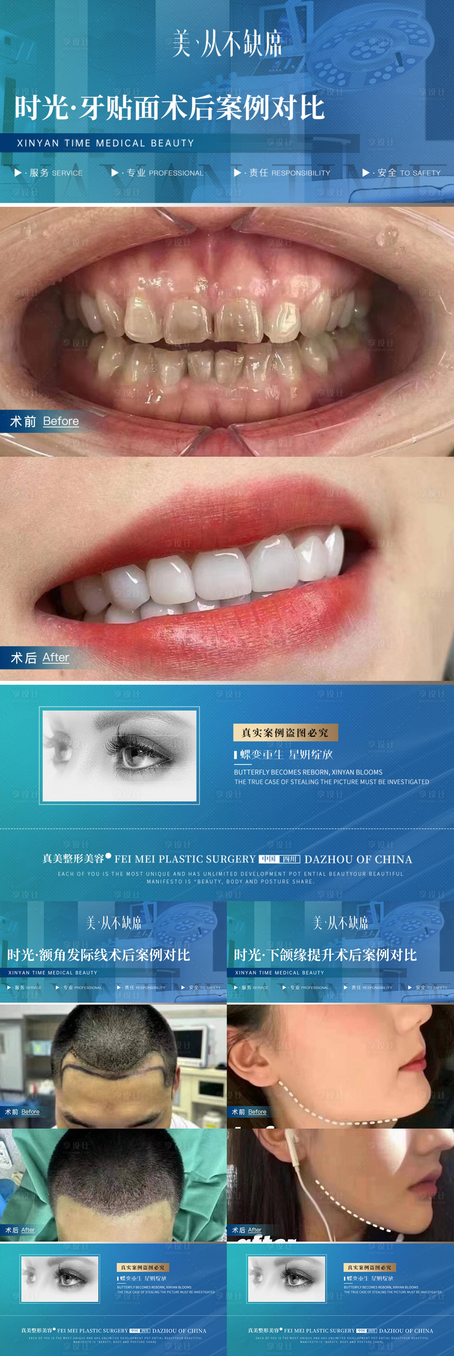 源文件下載【享設(shè)計(jì)】搜索編號(hào)：46110019936721262【醫(yī)美植發(fā)口腔案例對(duì)比】