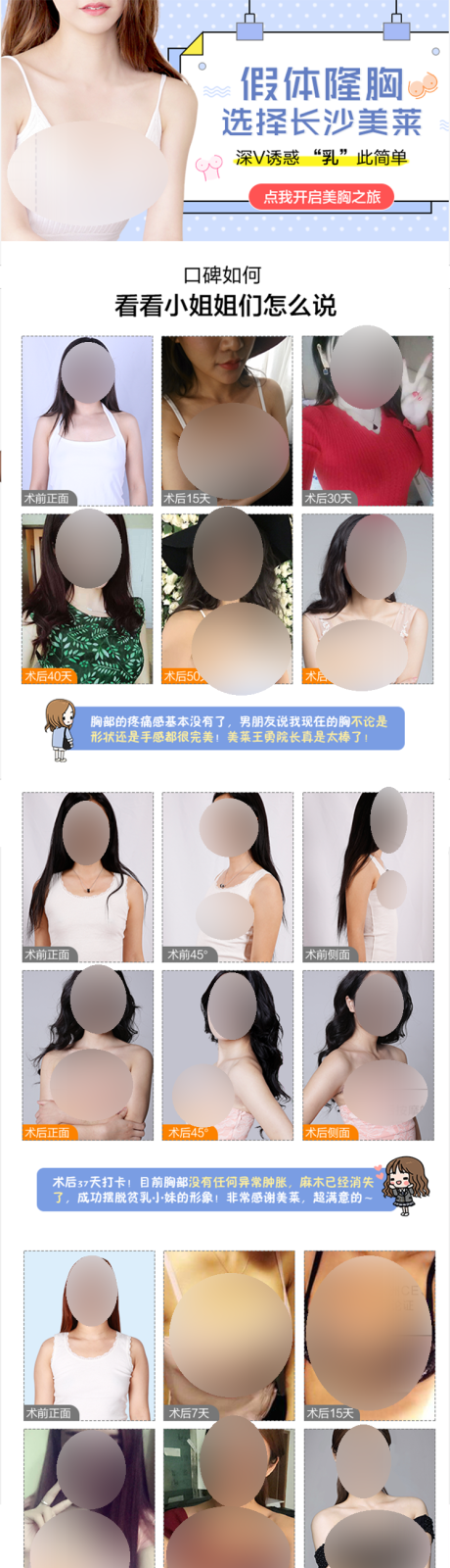 源文件下載【享設(shè)計(jì)】搜索編號(hào)：16490019912752491【醫(yī)美假體隆胸口碑詳情頁(yè)】