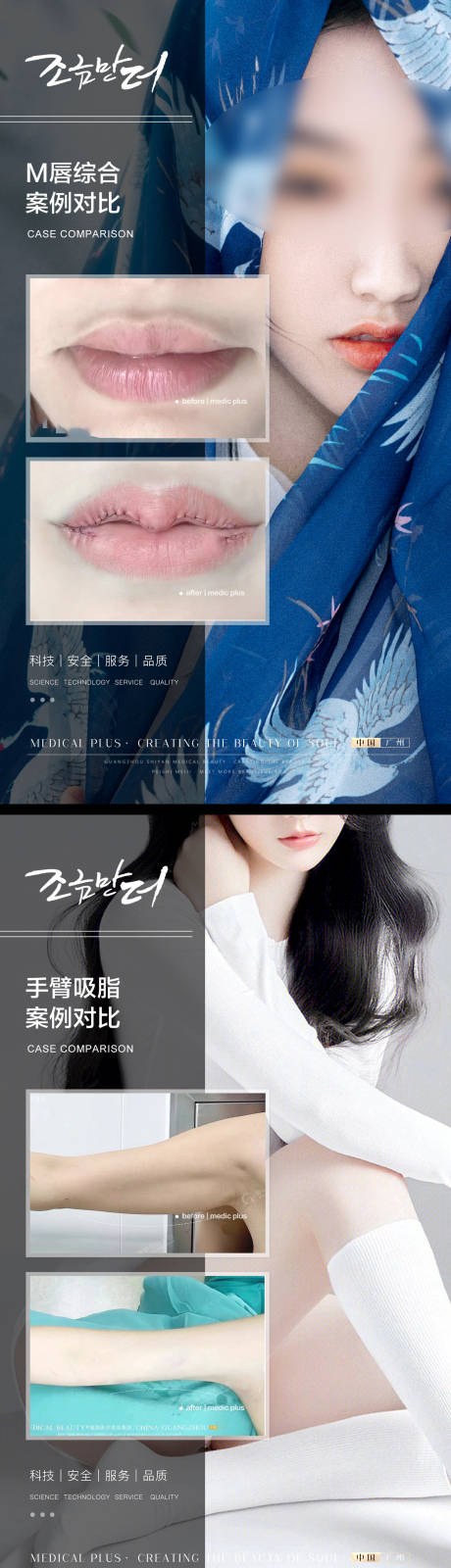 源文件下载【医美整形对比案例】编号：80110019894138438