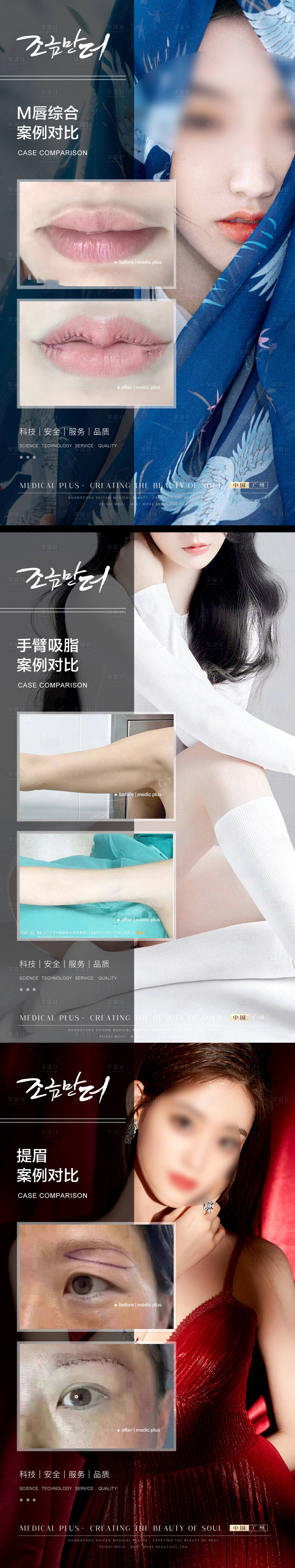 源文件下載【享設計】搜索編號：80110019894138438【醫美整形對比案例】