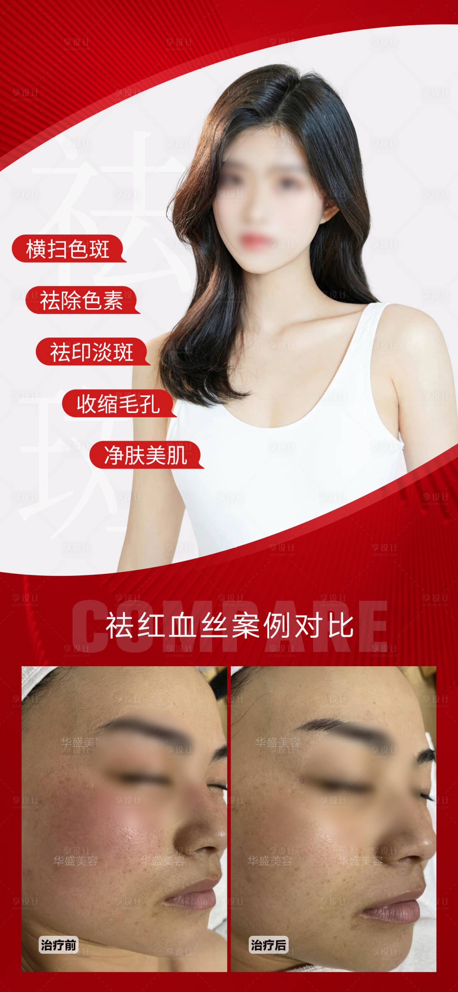 源文件下载【享设计】搜索编号：82370019834821476【医美祛斑美肤案例对比海报】