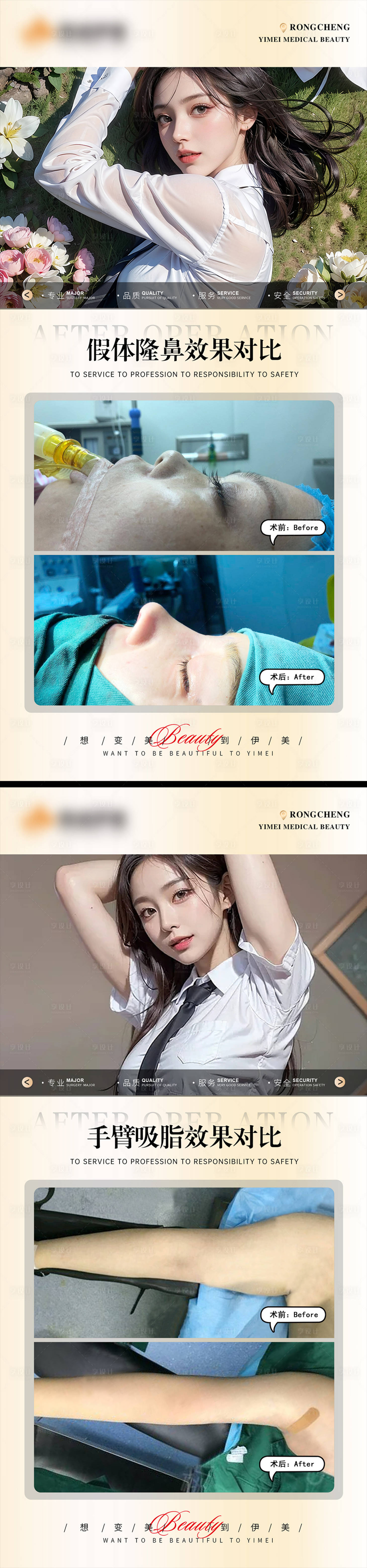 源文件下載【享設(shè)計】搜索編號：65190019988157068【醫(yī)美案例模板對比】