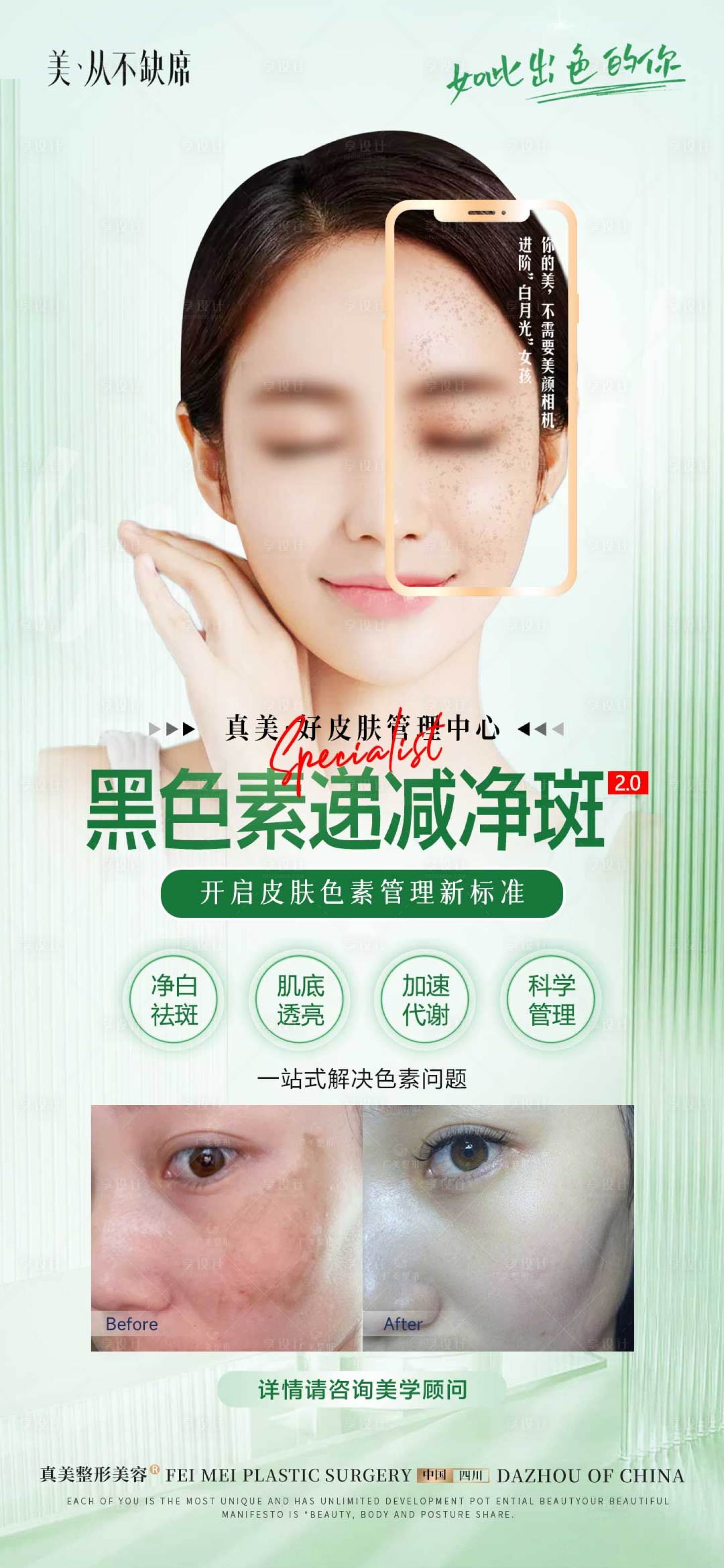 源文件下载【医美祛斑项目海报】编号：50760019936875366
