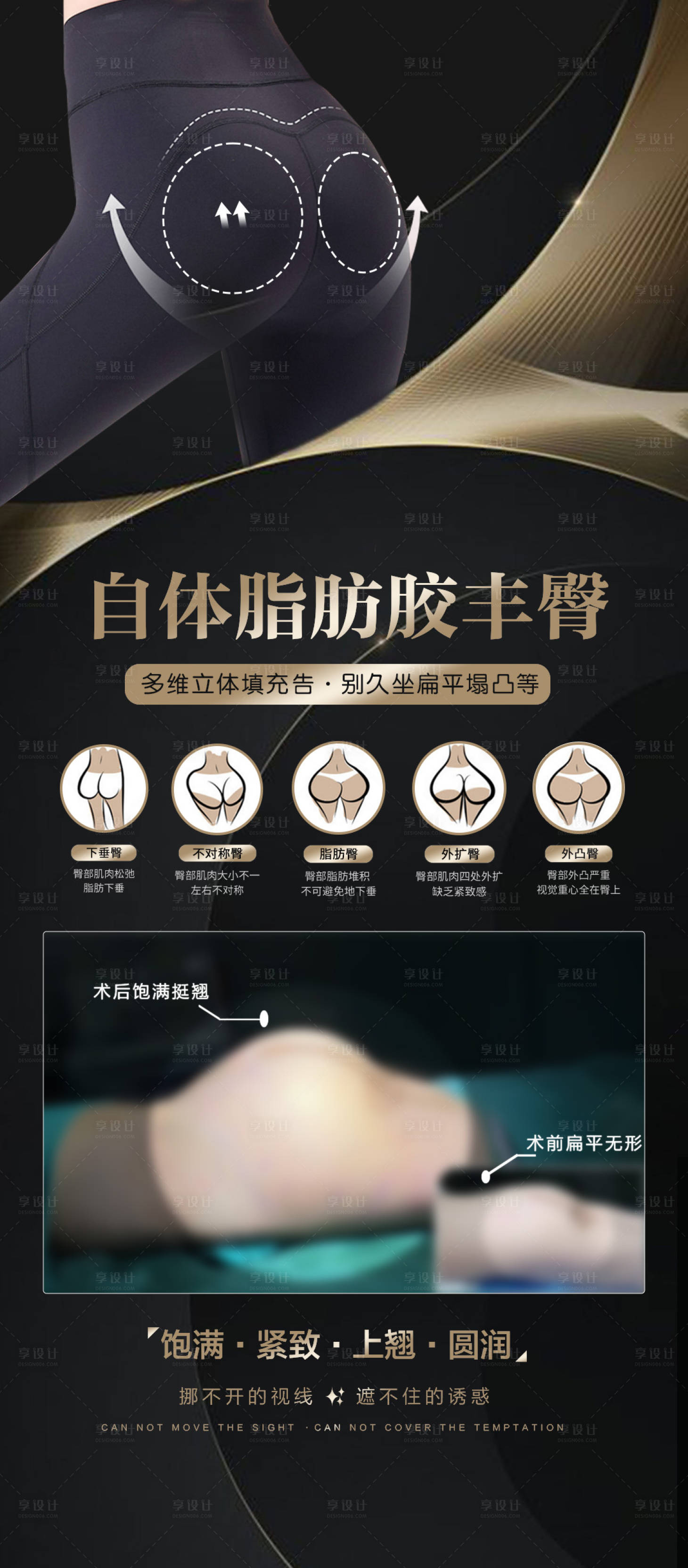 源文件下載【享設計】搜索編號：62370019619045516【自體脂肪豐臀海報】