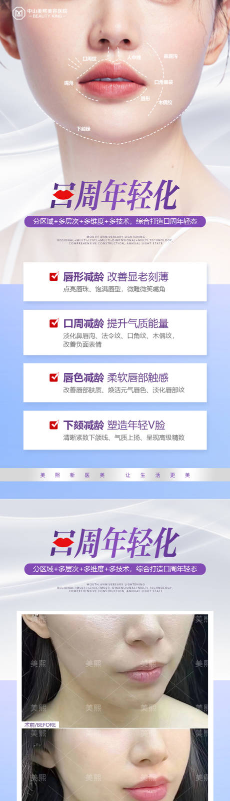 源文件下载【口周年轻化海报】编号：44880019948234789