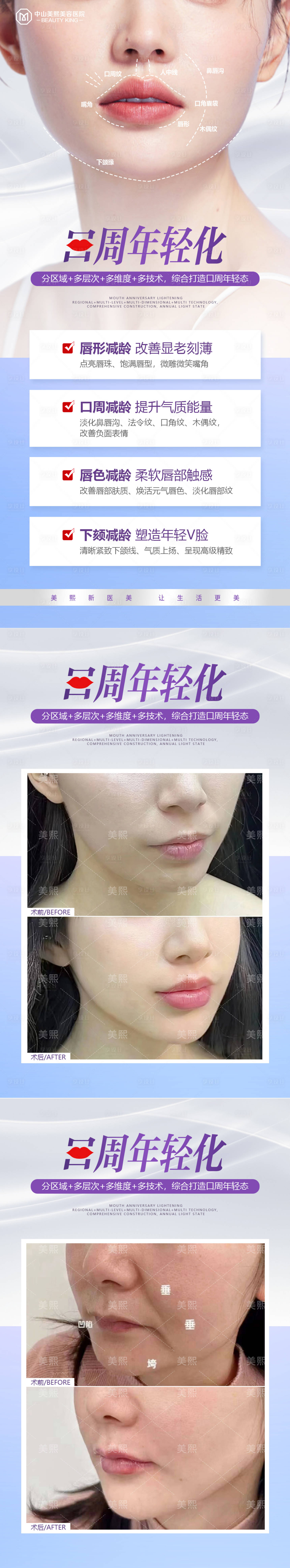 源文件下載【口周年輕化海報】編號：44880019948234789
