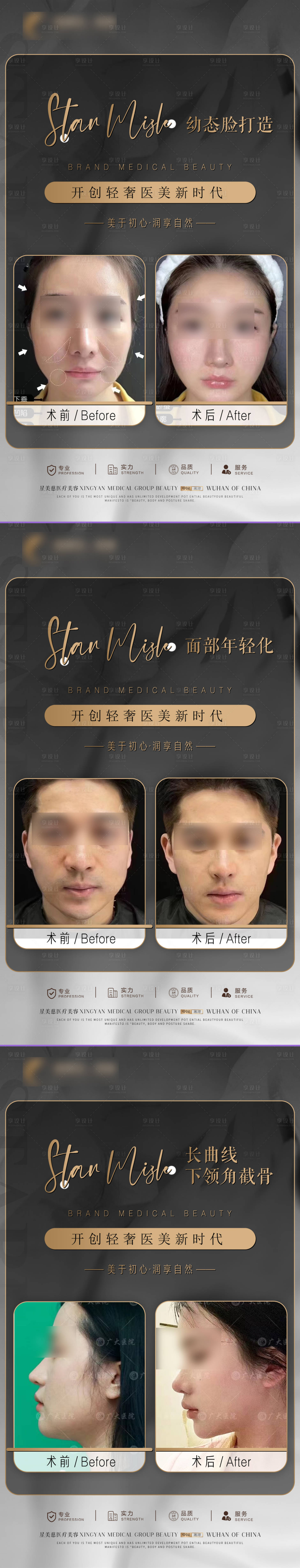 源文件下载【享设计】搜索编号：19760020111513006【医美轻奢案例系列海报】