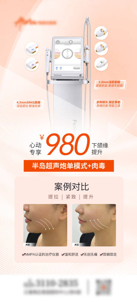 源文件下載【醫(yī)美卡項(xiàng)超聲炮】編號(hào)：65000020022194331